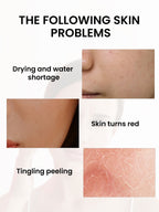 Turmeric Oil 30ml - For The Face Turmeric Serum For Dark Spots Corrector Serum For Face & Body, Anti Aging Facial Serum For Women Men, Reduces Hyperpigmentat
