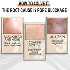 Jaysuing Lactobionic Acid Liquid Exfoliating Blackheads Shrinking Pores Cleansing Moisturizing Skin