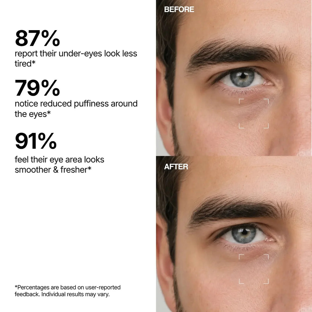 Hydrating Eye Rescue Serum – Lightweight Under Eye Care for Dark Circles & Fine Lines