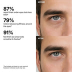 Hydrating Eye Rescue Serum – Lightweight Under Eye Care for Dark Circles & Fine Lines