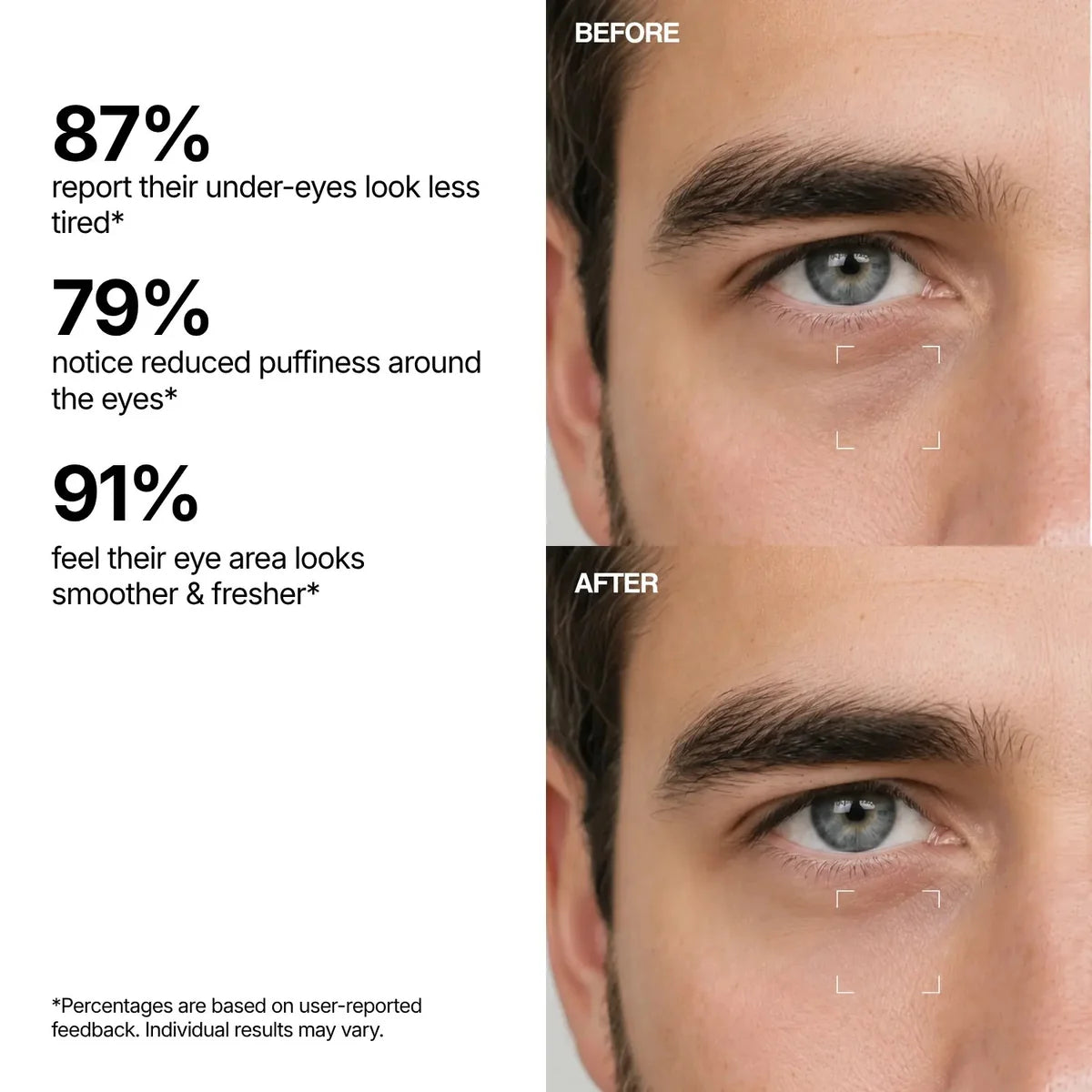Hydrating Eye Rescue Serum – Lightweight Under Eye Care for Dark Circles & Fine Lines